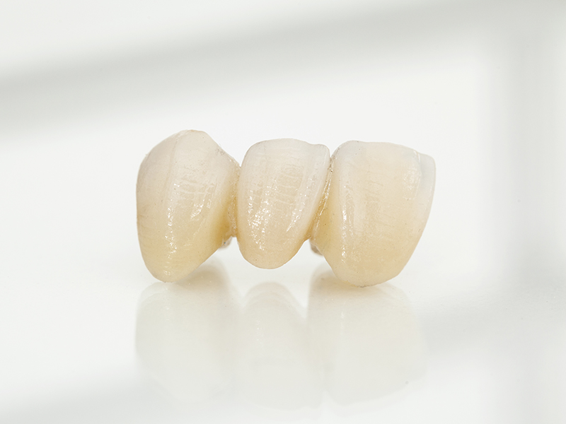 セラミック治療