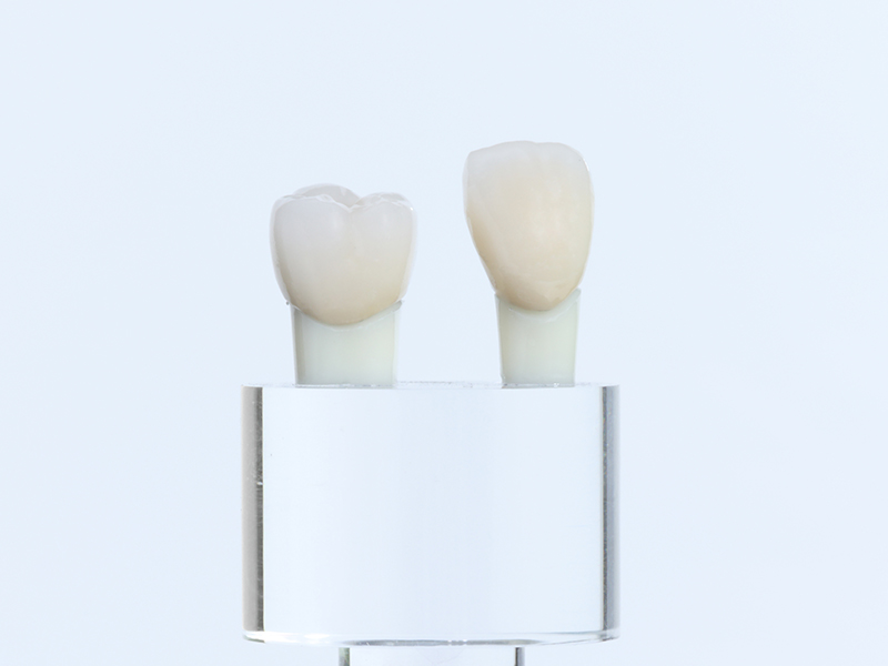 メタルボンド素材