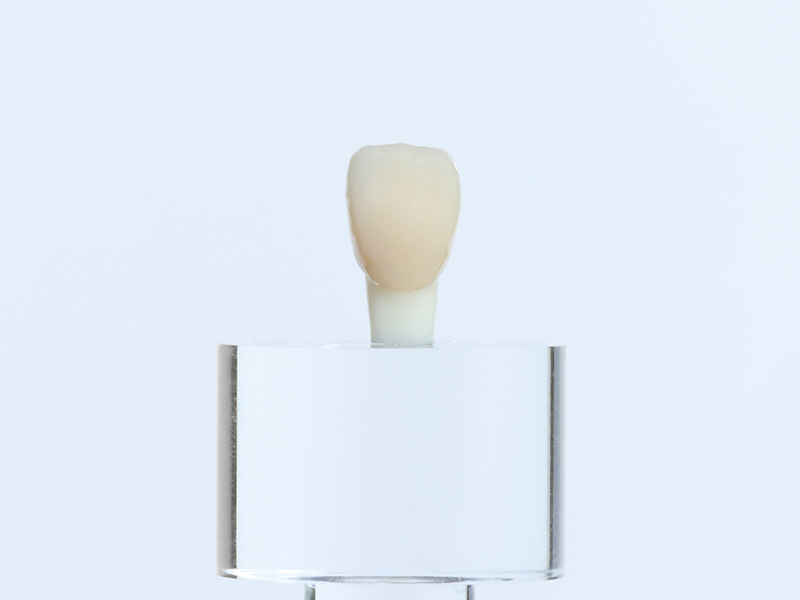 ラミネートべニア