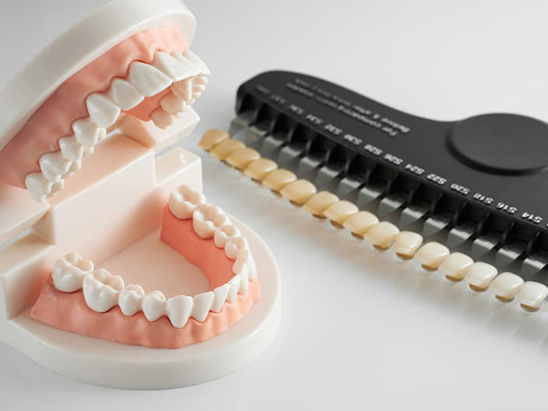 ホワイトニングとクリーニングの違い