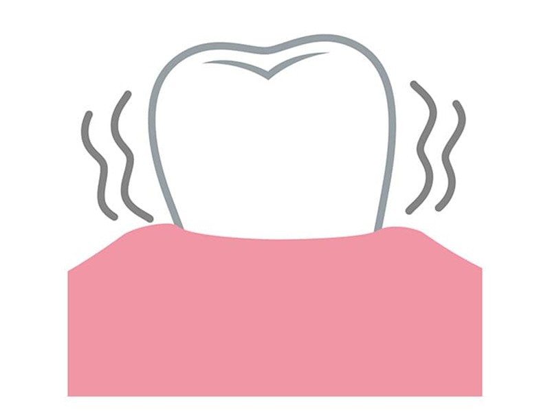 歯がぐらぐらする