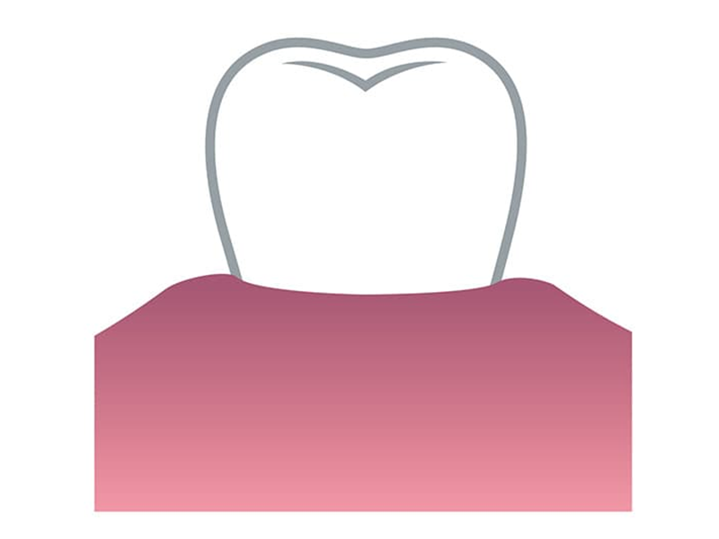 歯肉の色が悪い