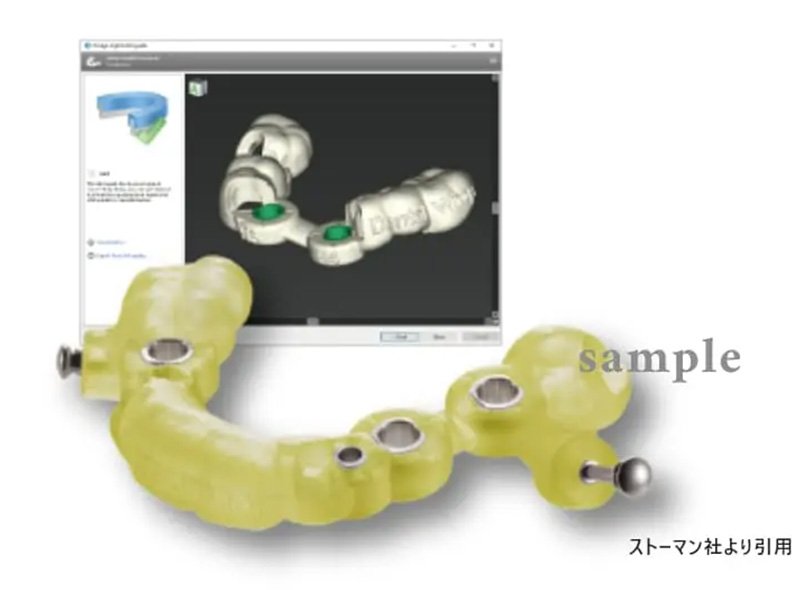 ガイデッドサージェリー