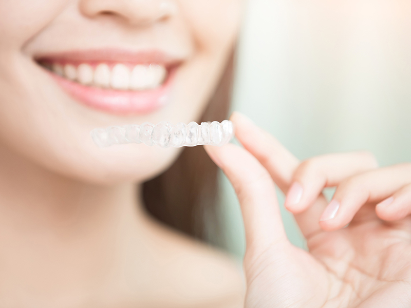 マウスピース矯正のイメージ